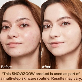 4 in 1 foundation Liquid- Hydrating Medium full coverage concealer -SPF 50  -Longwearing & Waterproof-korean makeup (Medium Spectrum -Gold Lid- for people with fair skin)