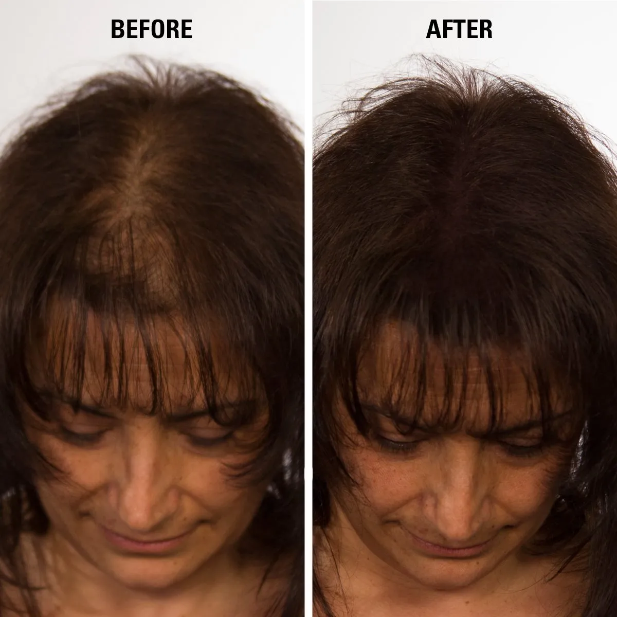 Hair Thickening Fiber - Hair Loss Concealer for Men & Women - Black, 15g