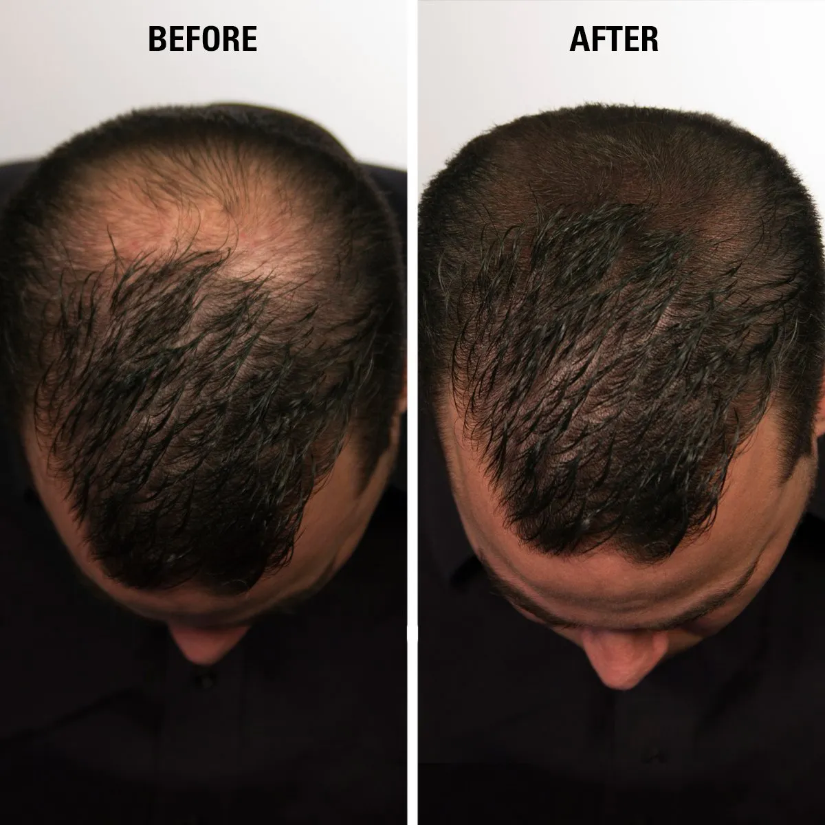 Hair Thickening Fiber - Hair Loss Concealer for Men & Women - Black, 15g