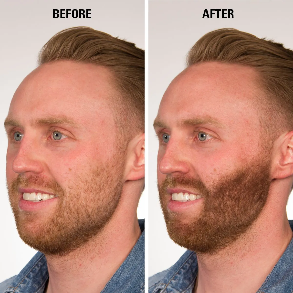 Hair Thickening Fiber - Hair Loss Concealer for Men & Women - Black, 15g