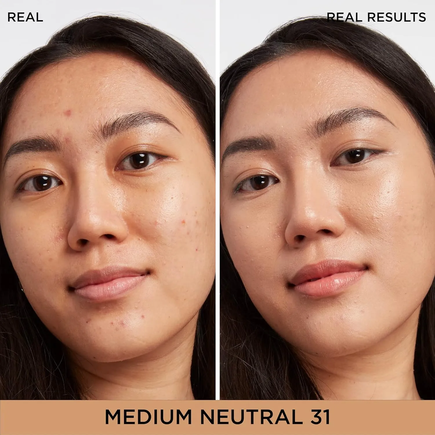 IT Cosmetics Bye Bye Dark Spots Concealer   Brightening Serum – 2% Niacinamide, Hyaluronic Acid & Caffeine - Medium Coverage, Natural Finish, All Skin Types - 0.22 fl oz