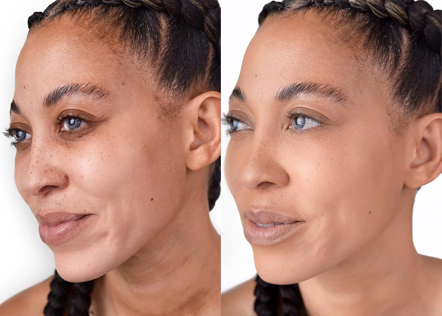 Loves-You-Back 3in1 Mineral Powder Foundation (CARAMEL 1) | Designed for acne-prone, sensitive skin reducing the appearance of acne and scars without layers | Vegan   Cruelty Free