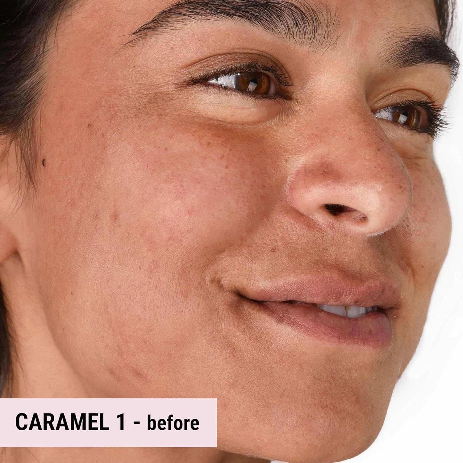 Loves-You-Back 3in1 Mineral Powder Foundation (CARAMEL 1) | Designed for acne-prone, sensitive skin reducing the appearance of acne and scars without layers | Vegan   Cruelty Free