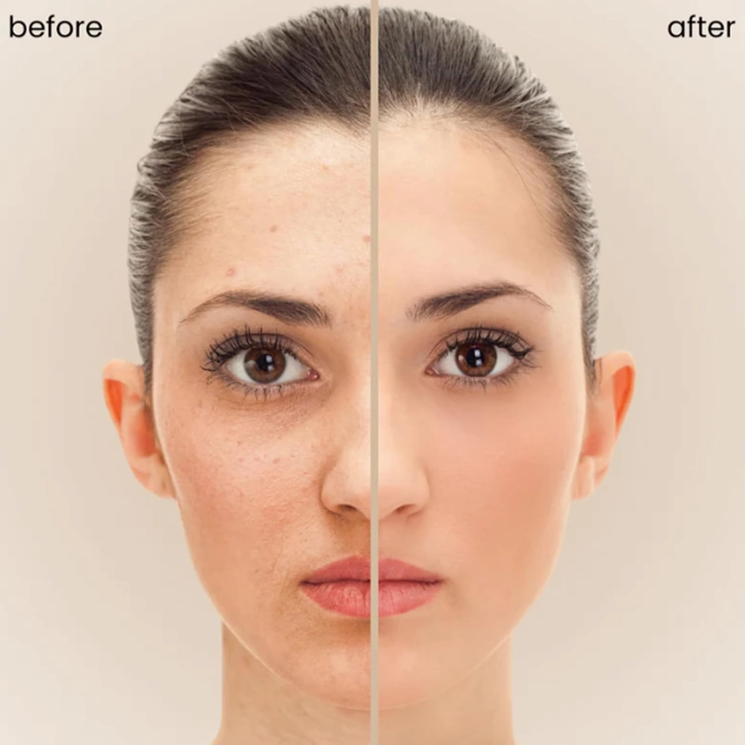 Vitaliq Skin Tint, Splendor Serum Boosted Skin Tint Balm, Korea Oasena Skin Tint Balm, Foundation Stick Beauty Serum Boosted Skin Tint, For Brightens, Hydrates, Natural Finish Makeup (#05 06)